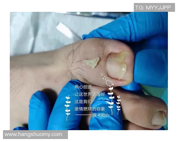 足球明星因甲沟炎困扰赛季表现专家解析病因与康复之道